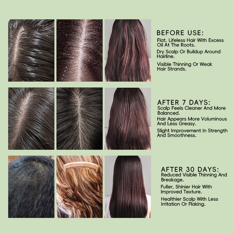 private label organic hair growth shampoo